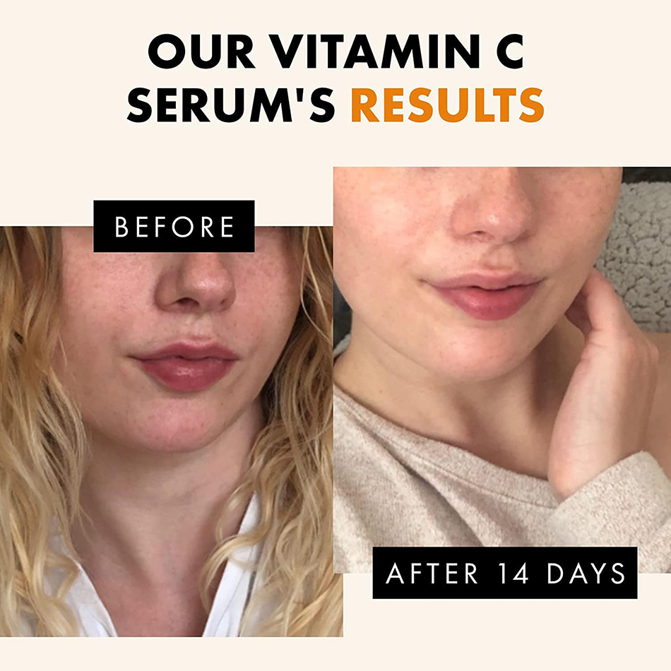 Super 120ml Siero alla vitamin - Vitamin C Serum Face recensione e prezzo